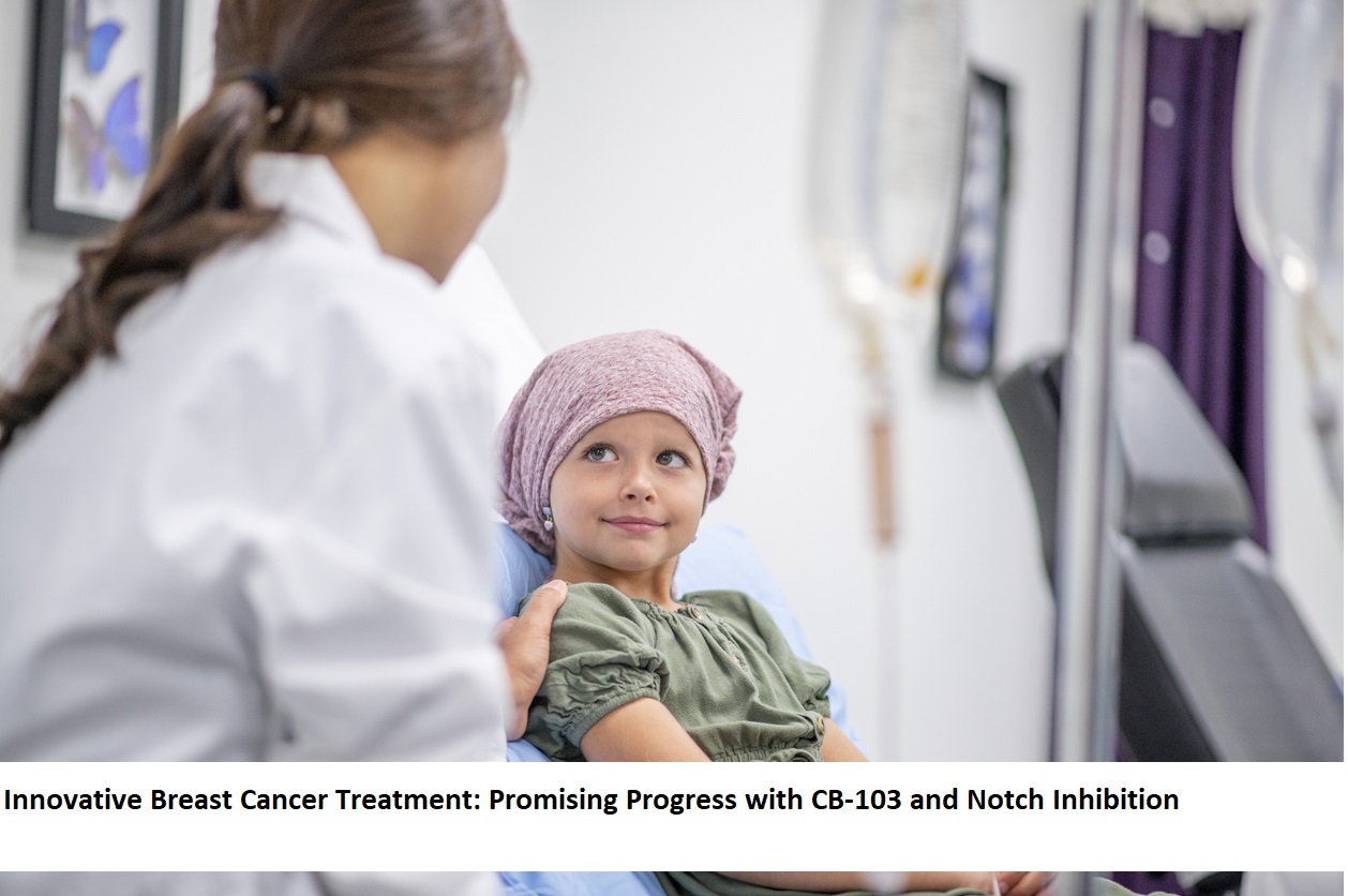 Innovative Breast Cancer Treatment Promising Progress with CB-103 and Notch Inhibition