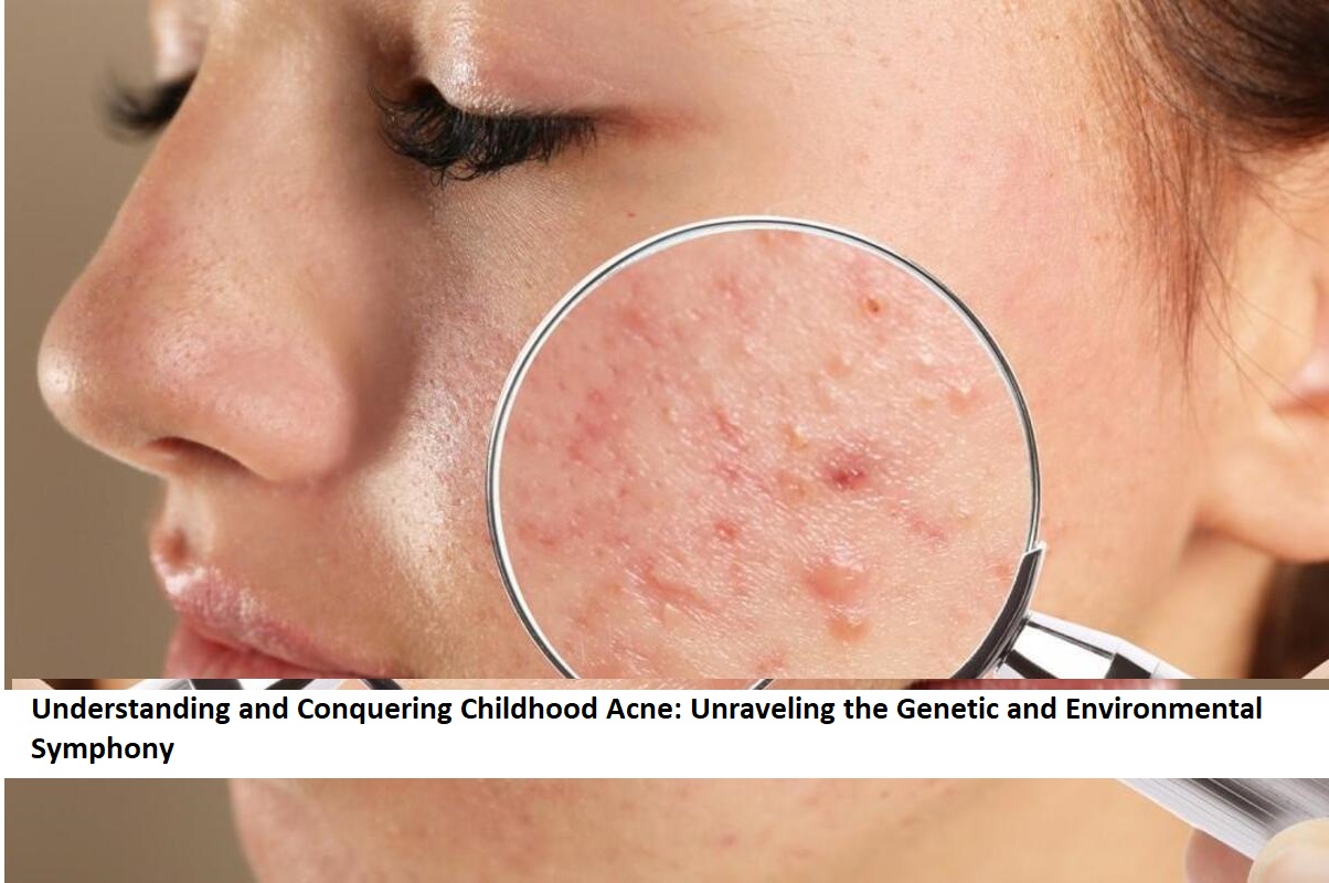 Understanding and Conquering Childhood Acne Unraveling the Genetic and Environmental Symphony
