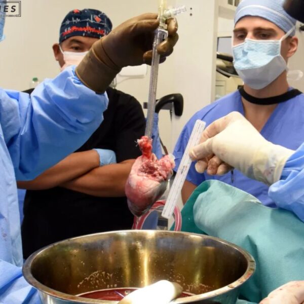 Xenotransplantation Pig Heart: Offers Hope for Organ Donation
