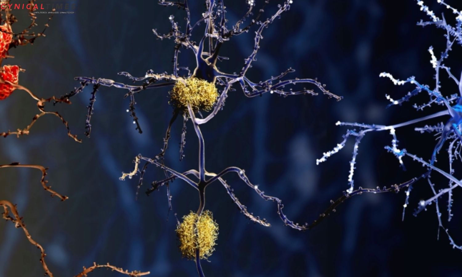Alzheimer Microglia Role